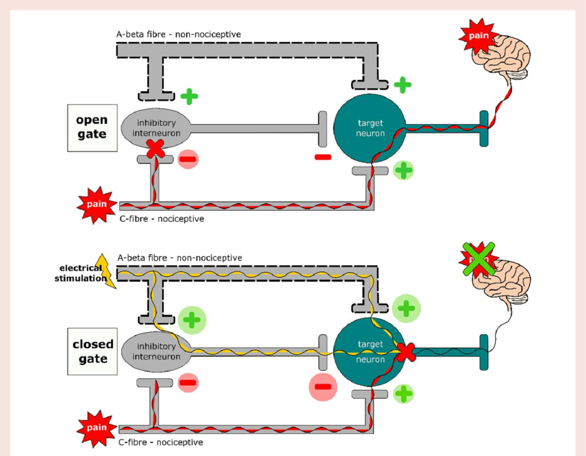 Gate-Control Theory of Pain Perception
